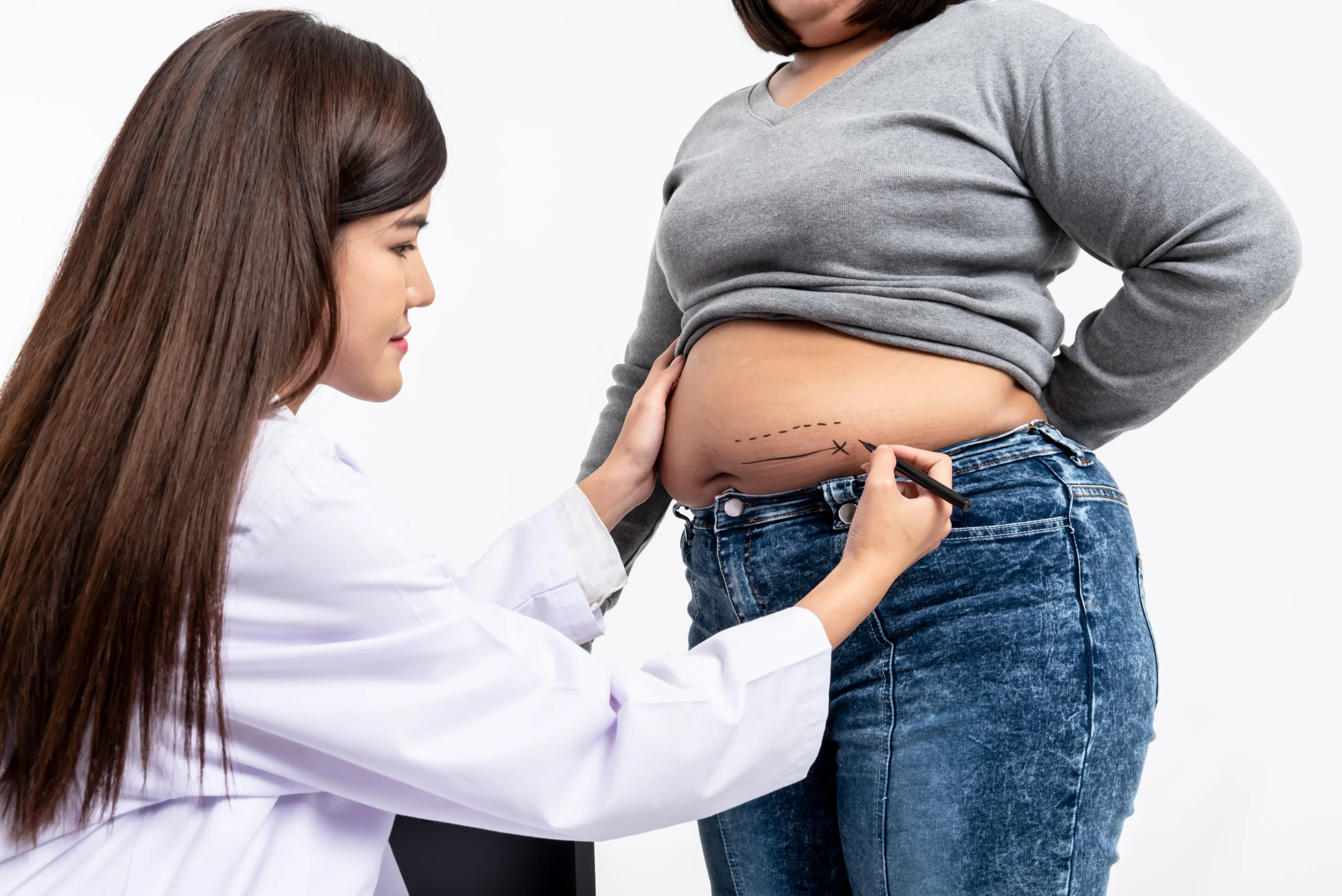 Weight Management at Meryl Aesthetics Mumbai